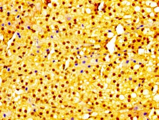 Polyclonal Rabbit anti-Human URI1 / NNX3 Antibody (IHC, WB)