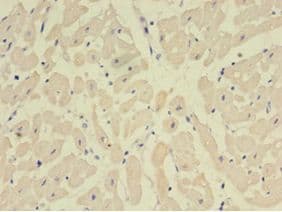 NPPB / BNP Antibody (aa27-102)