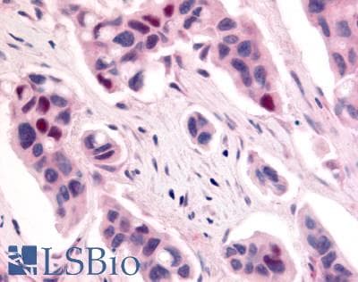 PathPlus™ Polyclonal Rabbit anti-Human CDK12 / CRKRS Antibody (Internal, IHC)