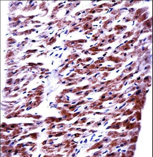 Polyclonal Rabbit anti-Human MRPL33 Antibody (aa36-65, IHC, WB)
