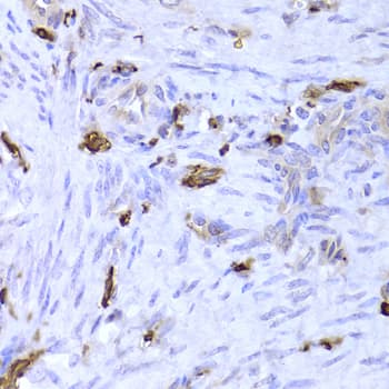 Polyclonal Rabbit anti-Human LSP1 Antibody (IHC, WB)