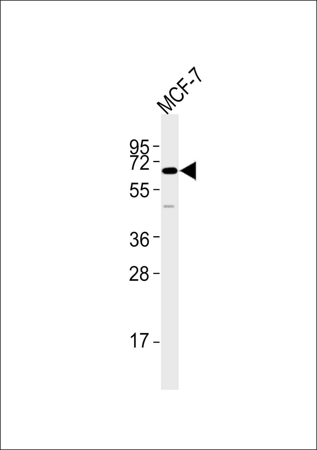 FRK Antibody