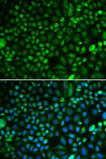 PA2G4 / EBP1 Antibody