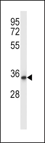 QPRT Antibody (aa206-234)