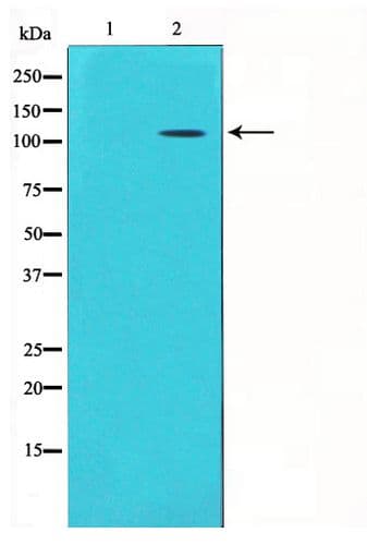 Polyclonal Rabbit anti-Human GRIK1 / GLUR5 Antibody (IHC, WB)