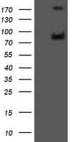 IHC-plus™ GLB1 / Beta-Galactosidase Antibody (clone 5H2)