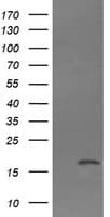 CTAG1B / NY-ESO-1 Antibody (clone OTI4G1)
