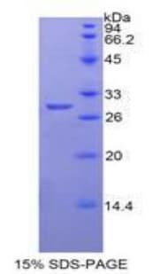 Human NPTX1 Protein (Recombinant His)
