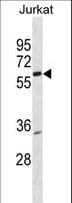 PKNOX2 Antibody (aa298-324)