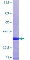 Human S100B / S100 Beta Protein (Recombinant GST)