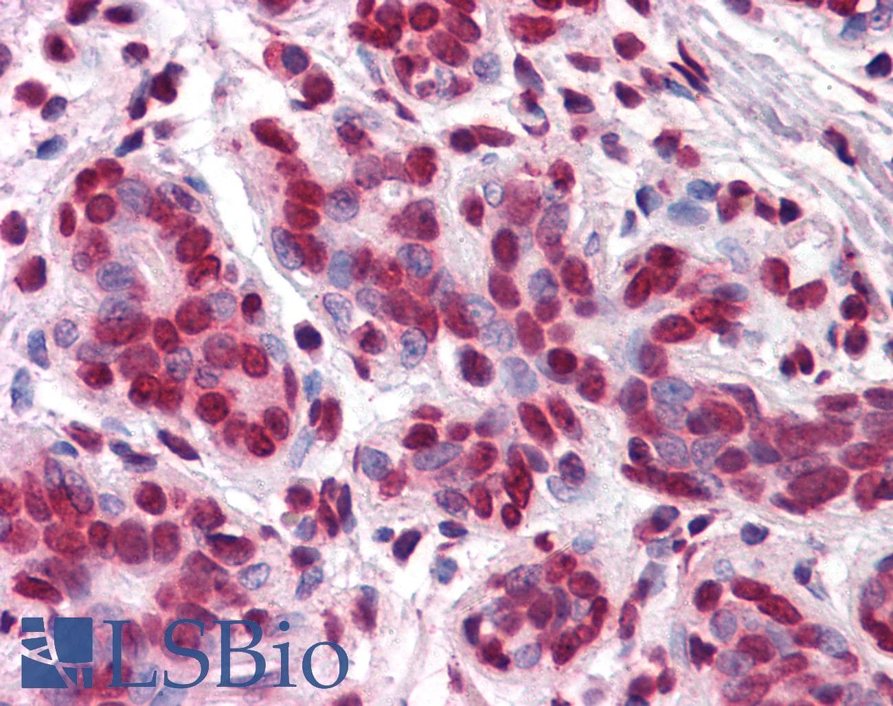 IHC-plus™ Vitamin D Receptor / VDR Antibody (clone 2F4)