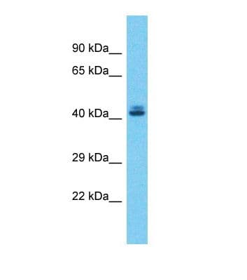 ZSCAN5 / ZSCAN5A Antibody (C-Terminus)