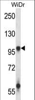 Polyclonal Rabbit anti-Human GRIA3 / GLUR3 Antibody (aa188-217, WB)