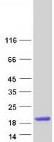 Human DEFA5 / Defensin 5 Protein (Recombinant Myc-DDK (Flag))