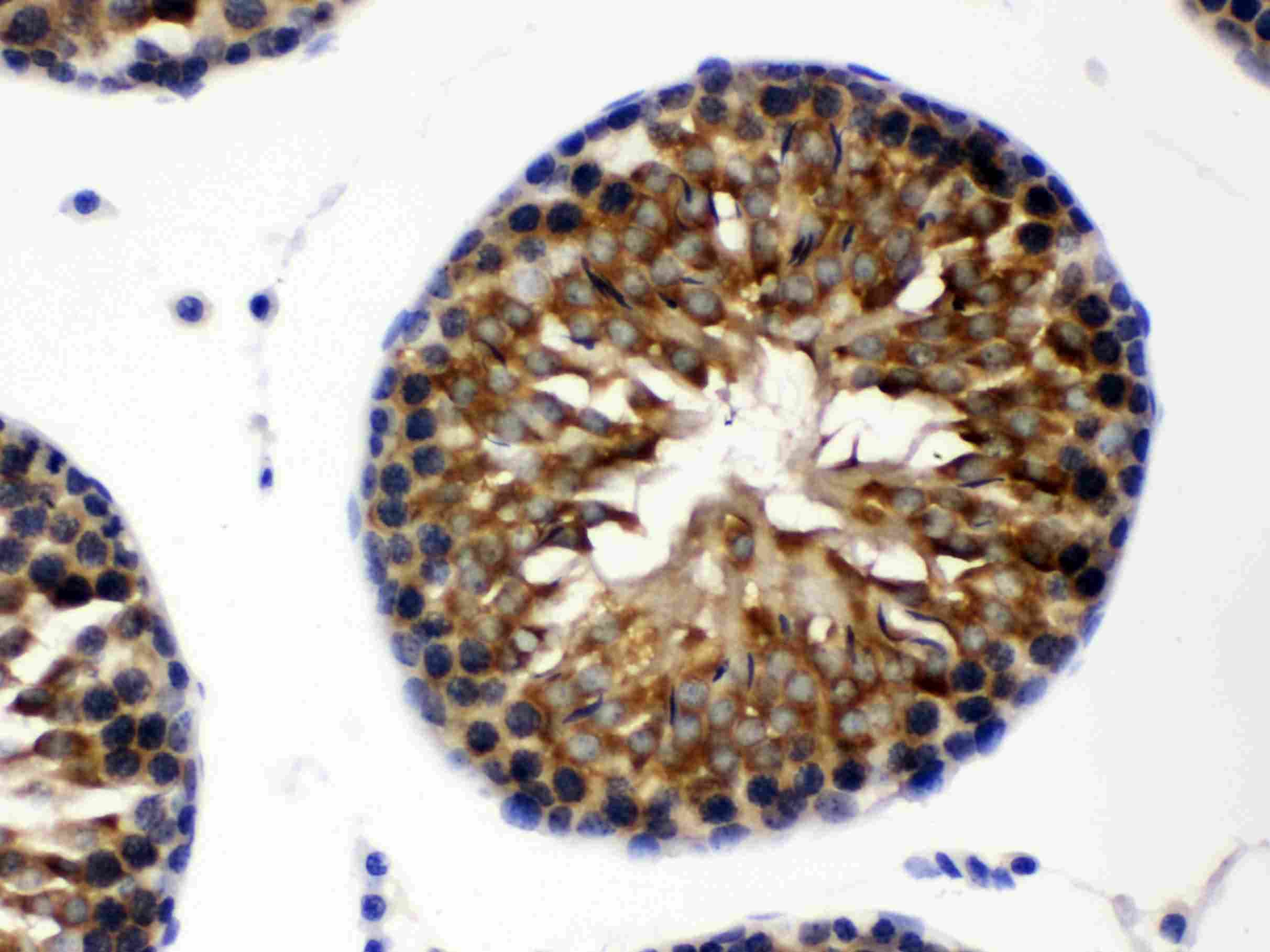 Polyclonal Rabbit anti-Human CCT8 Antibody (IHC, WB)