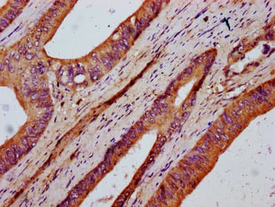 FKBP10 / FKBP65 Antibody