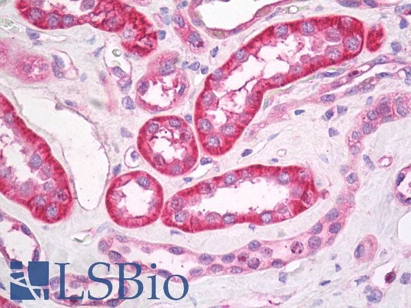 IHC-plus™ GABRB3 Antibody (clone S87-25)