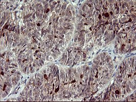 MMP13 Antibody (aa104-471, clone OTI3H3)