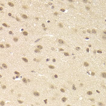 Polyclonal Rabbit anti-Human JMJD6 / PSR Antibody (IHC, IF, WB)