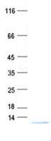 Human BOLA3 Protein (Recombinant His, N-Terminal)