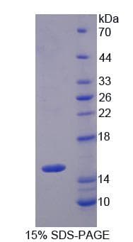 Human SLC22A4 / OCTN1 Protein (Recombinant His-T7)