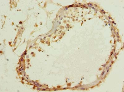 Polyclonal Rabbit anti-Human TTC16 Antibody (IHC)