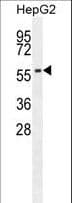 ADCK3 / CABC1 Antibody