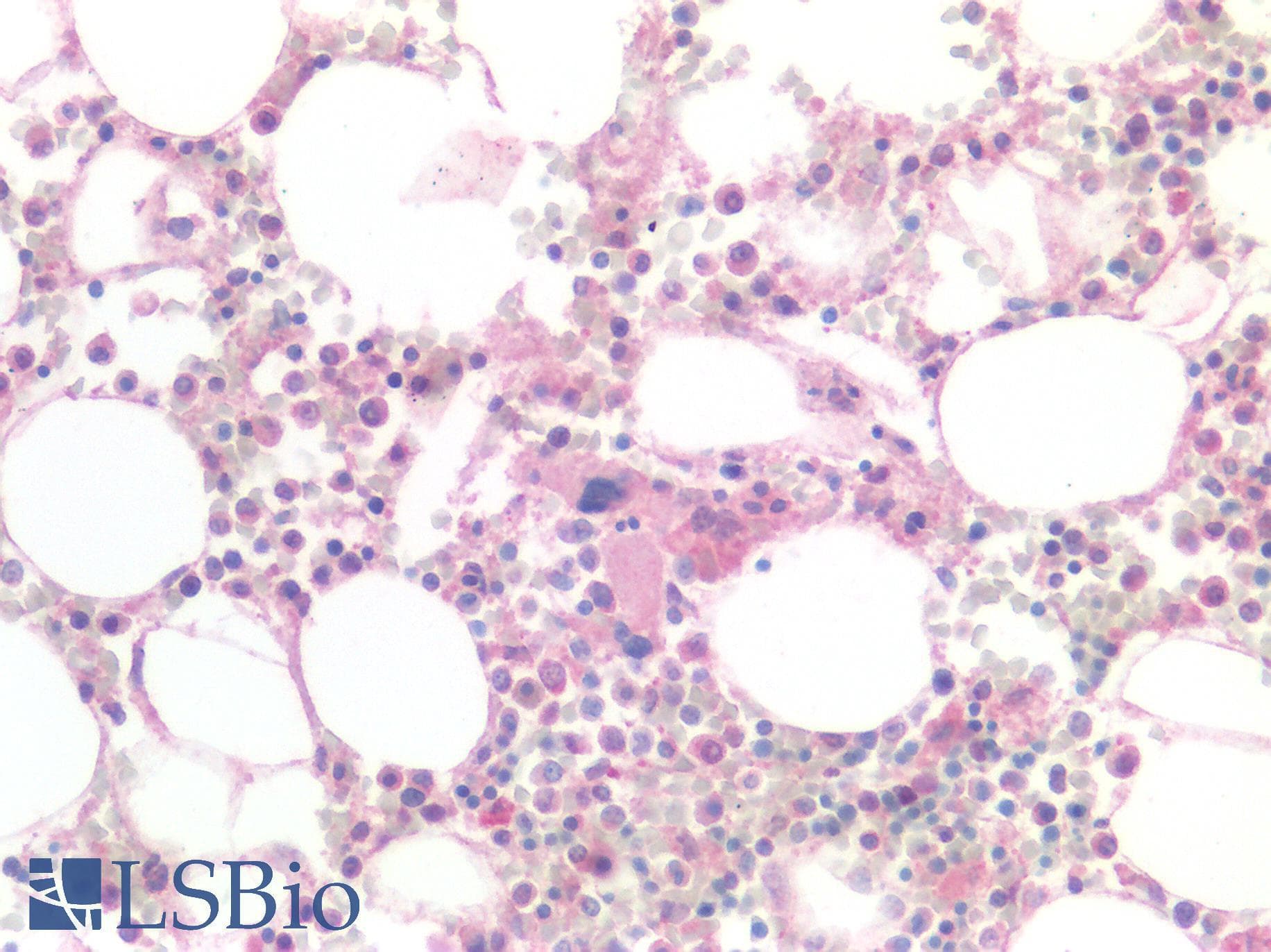 IHC-plus™ MSLN / Mesothelin Antibody