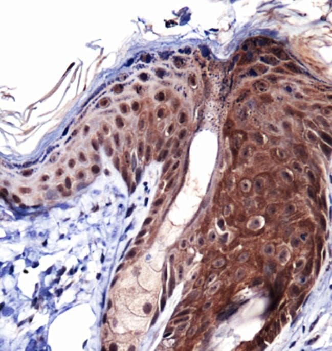 COL1A1 / Collagen I Alpha 1 Antibody (DY488)