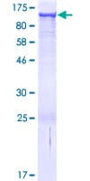 Human DHTKD1 Protein (Recombinant GST)