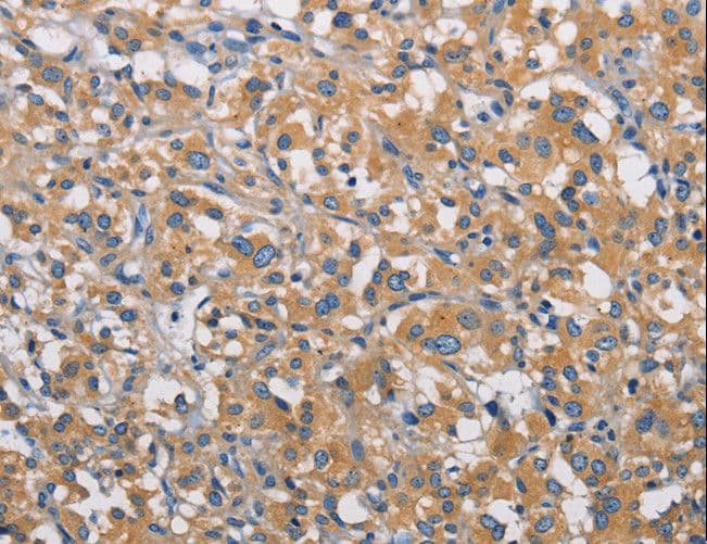Polyclonal Rabbit anti-Human PIKFYVE / PIP5K Antibody (IHC)