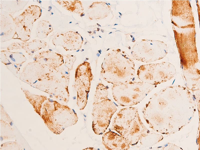 Polyclonal Rabbit anti-Human CHEK1 / CHK1 Antibody (phospho-Ser280, IHC, IF, WB)