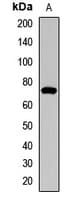 Polyclonal Rabbit anti-Human CDw218a / IL18R1 Antibody (WB)
