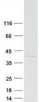 Human CHMP4B Protein (Recombinant Myc-DDK (Flag))