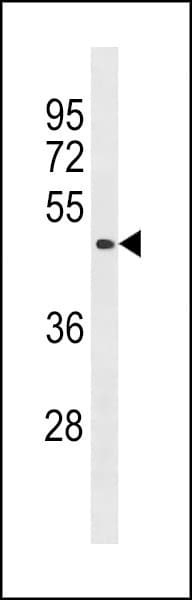 Polyclonal Rabbit anti-Human BCL6B Antibody (aa276-302, WB)