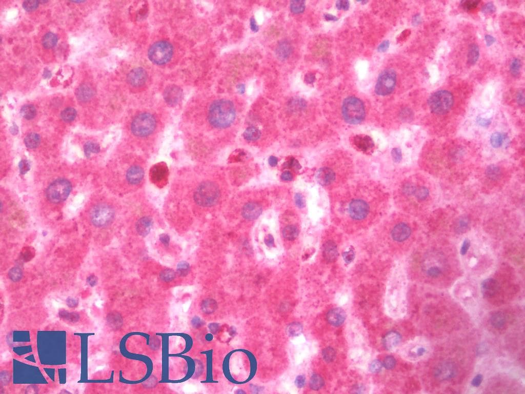 IHC-plus™ Polyclonal Rabbit anti-Human TNFSF4 / OX40L / CD252 Antibody (IHC, IF, WB)
