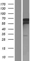 Human LARP1B Protein (Over-Expression Lysate Myc-DDK (Flag))
