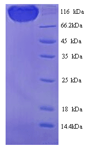 Rat PODXL / Podocalyxin Protein (Recombinant 6His, N-terminus)