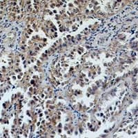 ERCC1 Antibody