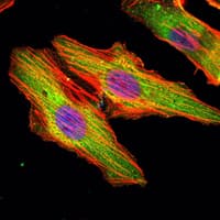 MATN1 / Matrilin 1 Antibody (clone 5A8)