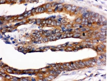Polyclonal Rabbit anti-Human RENT1 / UPF1 Antibody (IHC, WB)