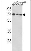IHC-plus™ ABI1 / SSH3BP1 Antibody (aa81-108)
