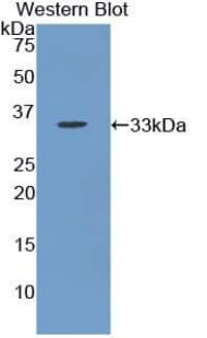 ACP5 / TRAP Antibody (aa28-286, Biotin)