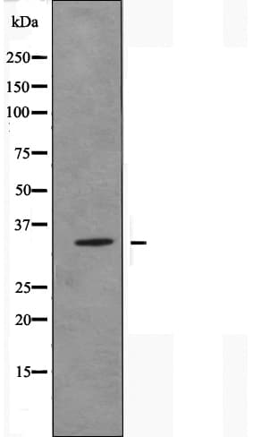 OR51E1 Antibody