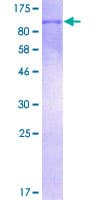 Human STAT6 Protein (Recombinant GST)