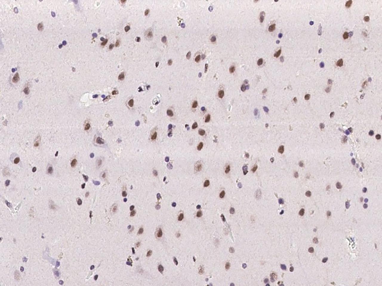 ZBTB7A / Pokemon Antibody