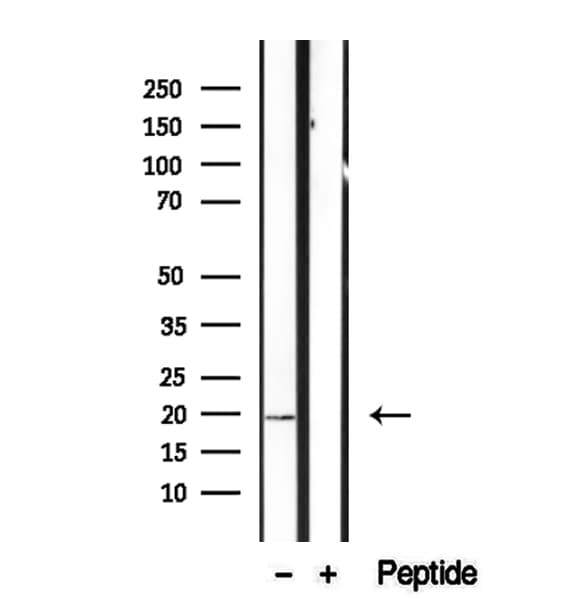 CPLX2 / Complexin 2 Antibody