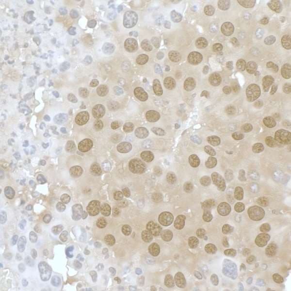PPP4C Antibody (aa1-50)