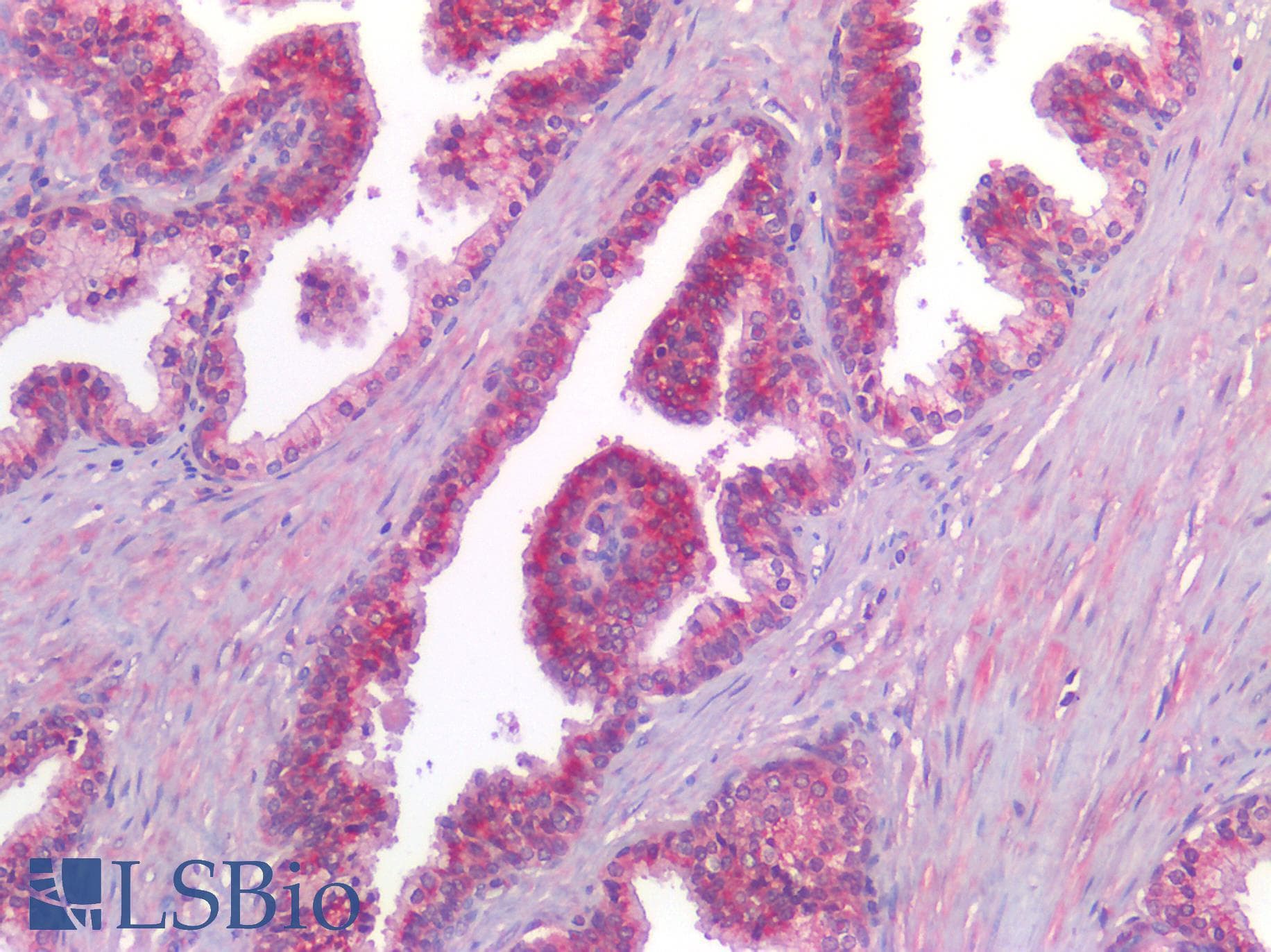 PathPlus™ CALCRL / CGRP Receptor Antibody (Cytoplasmic Domain)