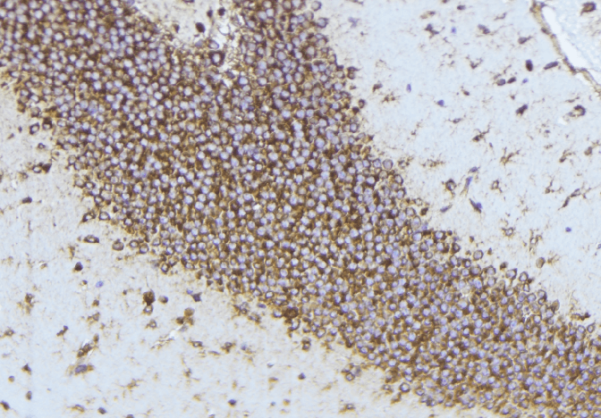 ADAMTS4 Antibody